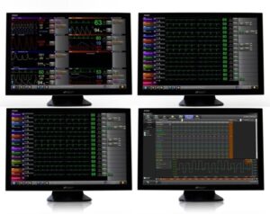 Monitorovací stanice Xhibit