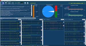 Software pro analýzu EKG záznamů LifeScreen Pro