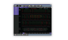 Intesys Clinical Suite G2 Intesys Clinical Suite G2